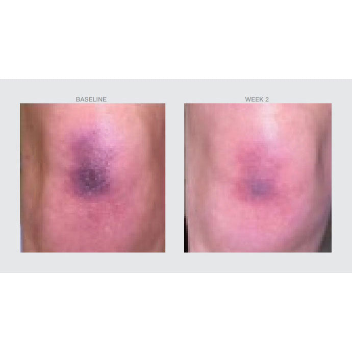Smooth Mineral Defense + Repair Sunscreen SPF 45